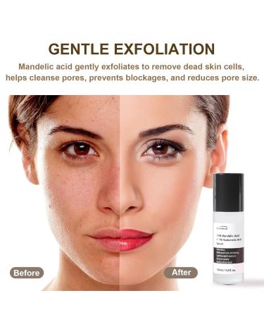 Mandelic Acid 10% + Hyaluronic Acid Serum 100ml - Gentle Exfoliation & Hydration for Radiant Skin - Buy Online on GoSupps.com
