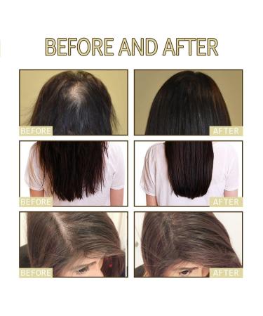 Veganic Natural Rosemary Oil by Carvenchi - Hair Growth & Repair - 60ml x 2 | Reduce Hair Loss Revitalize Damaged Hair - Buy Online on GoSupps.com