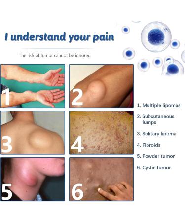 Lipoma Removal Spray Lipoma Reduction Anti-cellulite Body Shaper Spray for Men and Women 50ml - Buy Online on GoSupps.com