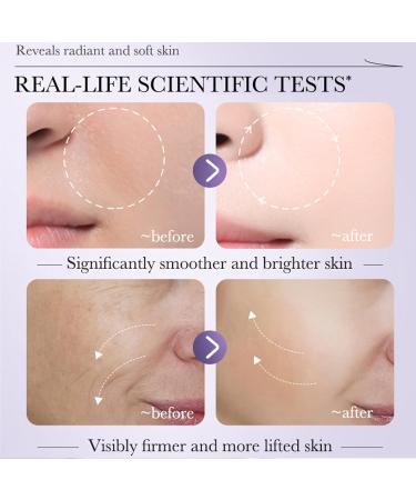 Skincare Set Gfits For Women & Girls Skin Care Pamper Gifts For Her Includes Vitamin C Serum Hyaluronic Acid Retinol Serum -Boost Skin Collagen Hydrate Plump Skin Anti Aging & Wrinkle - Buy Online on GoSupps.com