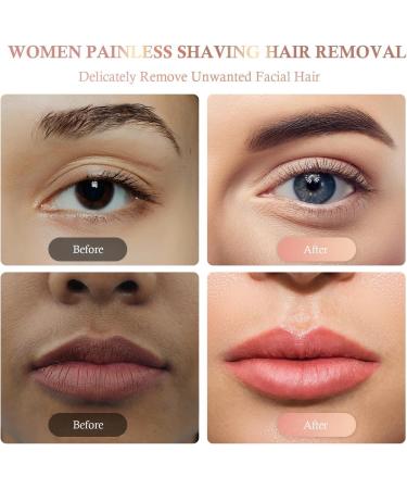 Facial Hair Removal for Women - Portable Rechargeable Lady Shaver & Painless Milky White Face Hair Remover - Buy Online on GoSupps.com