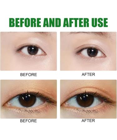 Hooded Eyelid Lifter Strips - Natural Eyelid Stickers for Hooded Eyes Invisible - Waterproof Droopy Eyelid Lifter Eye Tape for Dramatic Lift Heavy Saggy Uneven Mono Eyelids Pochy - Buy Online on GoSupps.com