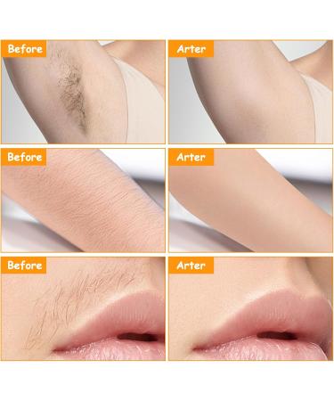 Cr me d pilatoire pour le visage hair removal cream cr me d pilatoire cr me d pilatoire pour la l vre sup rieure cr me d pilatoire pour le visage pour femme pilation douce sans irritation (1 pi ce) - Buy Online on GoSupps.com