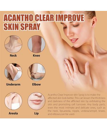 OAKITA Acanthoclear Therapy Spray - Acanthosis Nigricans Treatment for Dark Knuckle - 1PCS/2PCS - Buy Online on GoSupps.com