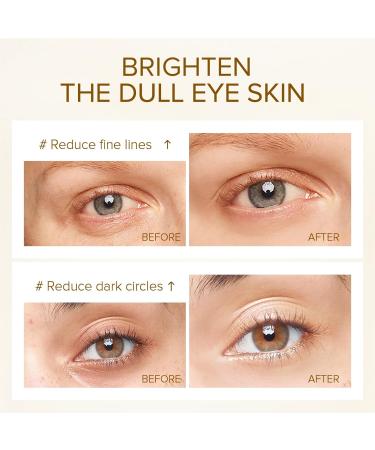 24K Gold Eye Serum Niacinamide Serum Anti Ageing Eye Serum Eye Serum For Dark Circles Puffy Eyes Bags Under Eyes Puffiness & Crows Feet Saggy Skin Anti Wrinkle Caffeine Eye Cream Brightening Serum - Buy Online on GoSupps.com