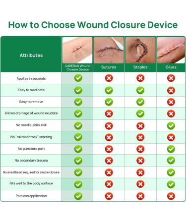 5pcs Zip Stitch Suture Free Wound Closure Strips | Butterfly Bandages for Emergency Laceration Repair - First Aid Kit Essential - Buy Online on GoSupps.com