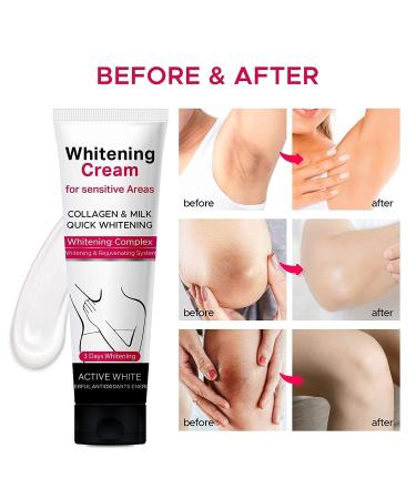 Natural and Mild Skin Lightening Cream for Face, Underarms, Neck, and Groin - Best for Dark Spots - Fast Results - Buy Online on GoSupps.com