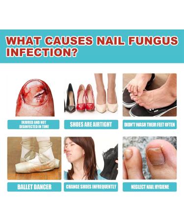 Fungal Nail Treatment Patches - Renewal Nighttime Anti Fungus Repair - Restores Healthy Nails - 16pcs - Buy Online on GoSupps.com