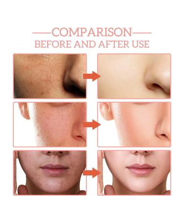 Buy 5 In 1 Facial Serum - 30% Vitamin C Anti-Aging Hydrating Serum with Niacinamide & Hyaluronic Acid - 1.05 Fl.oz (2PCS) - Wrinkle Reduction & Collagen Boost - Buy Online on GoSupps.com