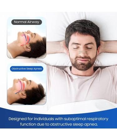 Breathe Better with Nose Strips - Reduce Snoring & Improve Sleep Quality (100PCS) - Buy Online on GoSupps.com