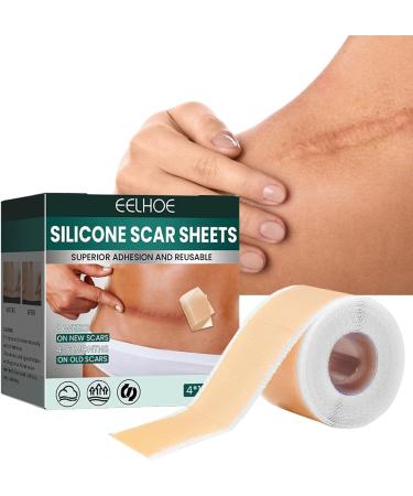Teksome Silicone Scar Sheets - Stretch Mark Remover | Soften & Flatten Scars | For Surgery Injury Burns C-Section | 1.57*59 Inches - Buy Online on GoSupps.com