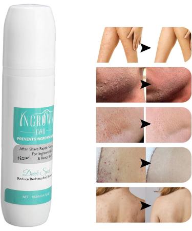 Tend Skin Ingrown Hair Solution - After Shave Treatment for Reducing Redness and Dark Spots - Buy Online on GoSupps.com
