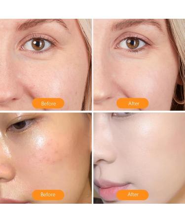 Reusable Oil-Absorbing Face Roller | Volcanic Stone Facial Scooter for Oily Skin | International Shipping - Buy Online on GoSupps.com