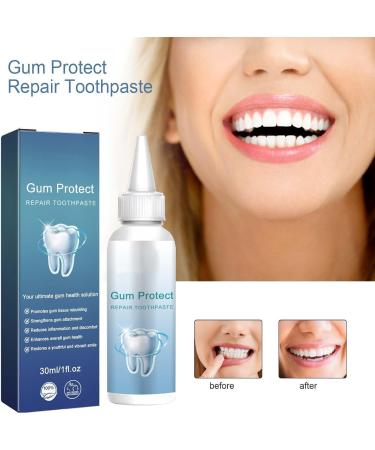  G n rique Gum Care Gel Teeth Repair Gel Gum Restoration Drops Essence Teeth Whitening Toothpaste Fresh Breath Cleaning Tooth Protection & Oral Care (2) - Buy Online on GoSupps.com