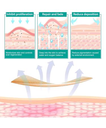 Silicone Scar Sheets Tape Strips 16 Pcs - Keloid C-Section Tummy Tuck Healing - Surgery Scars Treatment - Buy Online on GoSupps.com