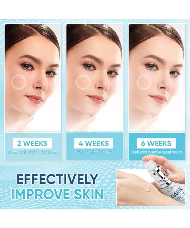 Dark Spot Remover for Face Body Serum Skin Brown Spot Remover Dark Spot Corrector Glow Serum Age Spot Remover Brighten Even Tone Improves Hyperpigmentation Gentle and Non-Irritating for Women and Men - Buy Online on GoSupps.com