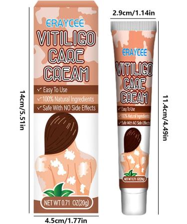  Hongjingda Skin lightening cream for vitiligo - 20g vitiligo relief cream for white patches on the skin reduces white patches improves epidermal melanocytes Hongjingda - Buy Online on GoSupps.com