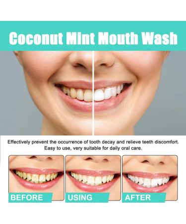 Coconut-Mint Mouth Care Set | Teeth Whitening Fresh Breath & Tongue Scraper - 100ml - Buy Online on GoSupps.com