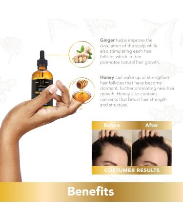 Melany's Hair Growth Drops: Ginger & Honey Anti-Thinning Treatment for Daily Hydration Strengthening & Volumizing Fuller Hair - Natural Herb Support - Buy Online on GoSupps.com