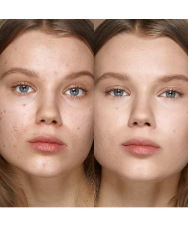 KIKO MILANO Full Coverage Concealer - Skin Tone Light 01 | Cruelty Free | Made in Italy - Buy Online on GoSupps.com