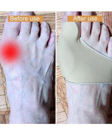 LINXIU Hallux Valgus Splint Socks - Toe Spreader & Hammer Toe Pain Relief | 1 Pair - International Shipping - Buy Online on GoSupps.com