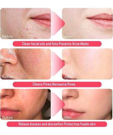 Retinol & Vitamin Complex Face Cleanser Gel Aloe Vera Face Wash for Oily Skin & Gently Cleaning Pores Gentle Face Wash to Purify Soothe & Calm Refreshing Gel Facial Cleanser for Sensitive Skin - Buy Online on GoSupps.com