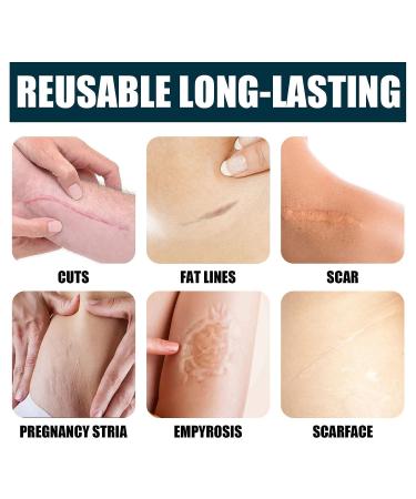 Scar Removal Cream 2pcs - Mild Gel for Old & New Scars, Stretch Marks, Wrinkles - 50ml - Buy Online on GoSupps.com