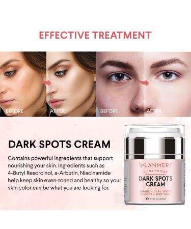 Lanmeri Dark Spot Remover | Face & Body Corrector Cream for Women & Men | Age, Brown, Sun Spot & Freckle Remover | All Skin Types - Buy Online on GoSupps.com
