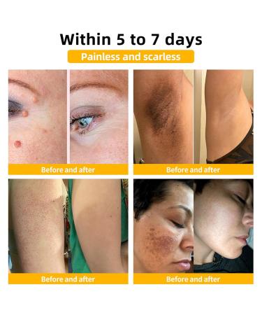 dooeka BIUTIFUL Bee Venom Skin Cream 2024 New Bee Venom Psoriasis Cream Beautiful Professional Bee Venom Correcting Cream for All Skin Types 1.69oz (1 Bottle) - Buy Online on GoSupps.com