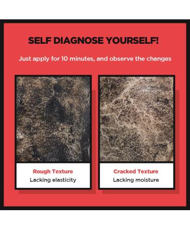 SKIN1004 Zombie Beauty MUMMY PACK & ACTIVATOR KIT | Hydrating Face Mask Set - Buy Online on GoSupps.com