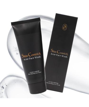 Acne Face Cleanser - Advanced Formula with Niacinamide Purifying Clay and Salicylic Acid for Oil Control and Skin Comfort - Paraben-Free Non-Comedogenic