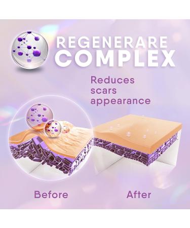 Scar Ointment & Gel | Effective Stretch Mark Removal | Scar Cream for Post-Surgery Care - Buy Online on GoSupps.com