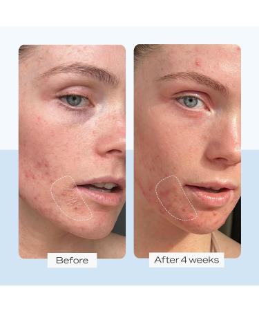 First Aid Beauty Ultra Repair Cream - Intense Hydration Moisturiser for Face & Body | 170.1g Rich Whipped Texture - Buy Online on GoSupps.com