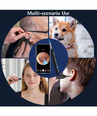 Ear Wax Removal Ear Wax Removal Tool Camera with 1440P Ear Cleaner with Camera and 7 Pcs Ear Set Earwax Removal Kit with 6 Led Lights for iPhone IPad Android Phones (Black) - Buy Online on GoSupps.com