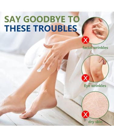 Yeast Ointment & Skin Cream - Repair Dry Skin for All Types (1PC) | Gentle Yeast Remedy for Men & Women - Buy Online on GoSupps.com