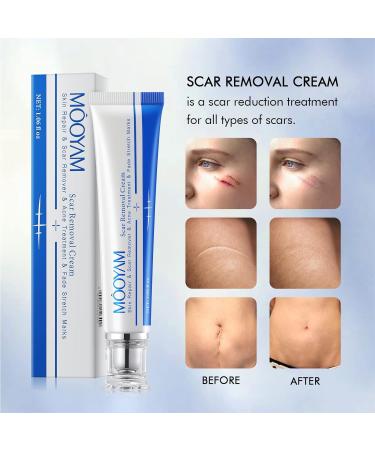 Scar Removal Cream - Rapid Repair for Acne, Surgery, Injury & Burns - 30g - Buy Online on GoSupps.com