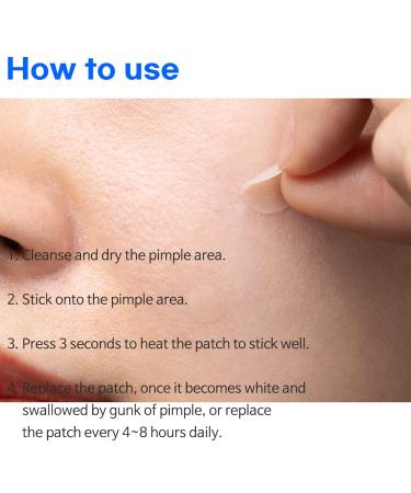 TIAM Surprise B Hydrocolloid Acne Pimple Patch - 96 Count (Pack of 4) | Fast Shipping Worldwide - Buy Online on GoSupps.com