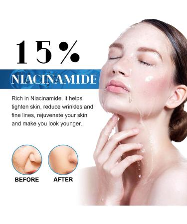 Face Serum for Women - 15% Niacinamide Serum - Hyaluronic Acid Serum for Face - Dark Spot Correcting Glow Serum - Moisturizing Collage Face Serum - Reduce Acne Nourish - Buy Online on GoSupps.com