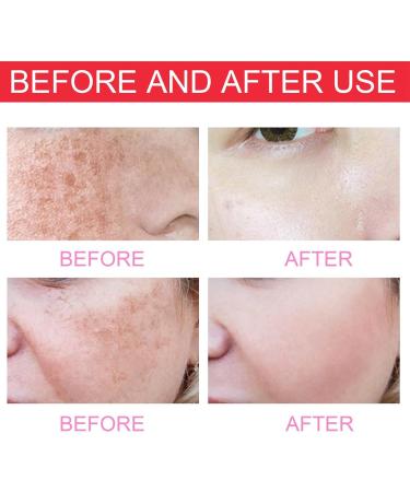 Serum for Dark Spot Face Serum for Women Skincare Serum for Face Dark Spot Correcting Glow Moisturizing Serum Skin Moisturizing Face Serum Face Skin Serum Effectively Lighten Skin Tone for Women - Buy Online on GoSupps.com