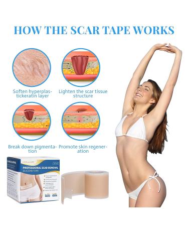 Professional Silicone Scar Sheets Roll - 60 x 1.6 Inches | Reusable Treatment for Keloid, C-Section, Surgery & Acne Scars - Buy Online on GoSupps.com