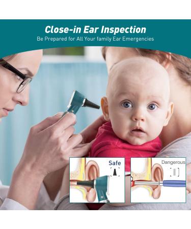Scian Otoscope Ear Scope with Light Ear Infection Detector Pocket Ear Checker Kit with 3X Magnify lens & 8 Speculum Tips for Kids Elders Dogs Home Use (Green) - Buy Online on GoSupps.com