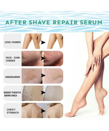 Ingrown Hair Treatment Serum - After Shave Repair for Men & Women 100ml - Buy Online on GoSupps.com