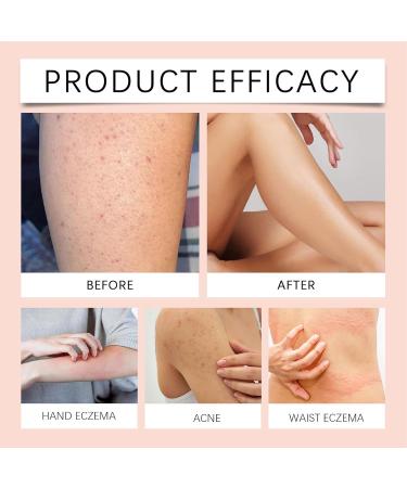  G n rique Organic Tallow Face Cream Grass-Fed Beef Tallow Balm Infused With Raw Wild Honey Deeply Moisturizing & Nourishing (120g) Perfect For Soft Supple Skin & Natural - Buy Online on GoSupps.com