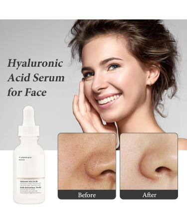 Hyaluronic Acid 2% + B5 30ML Hyaluronic Acid Serum for Face Dark Spot Remover for Face Hyaluronic Acid Face Moisturize Skincare Serum for Face to Plump and Smooth Skin for All Skin Types Skin Care - Buy Online on GoSupps.com