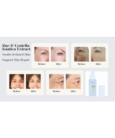 Advanced Retinol Serum Skin Booster- Face, Neck Anti Aging Night Serum - Hyaluronic, Niacinamide, Collagen, Glycolic Acid, Vitamin C & E for Wrinkles, Fine Lines & Dark Spots for Women & Men Hydration Boost 1.7 Fl Oz (Pack  - Buy Online on GoSupps.com