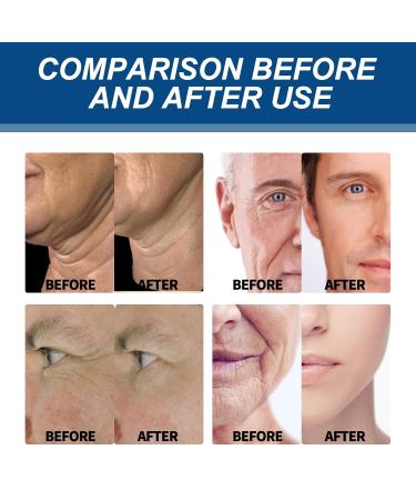 Men's Collagen Anti-Aging Face Moisturizer 50g | Retinol Hyaluronic Acid & Vitamin E | Reduces Wrinkles Firms Skin 24H Hydration | All Skin Types - Buy Online on GoSupps.com