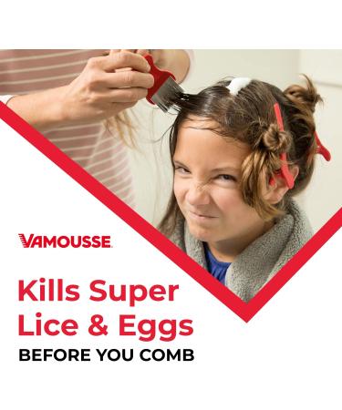 Vamousse Lice Treatment Complete Kit - Kills Super Lice & Eggs - No Harmful Chemicals - Suitable for Kids & Adults - Buy Online on GoSupps.com