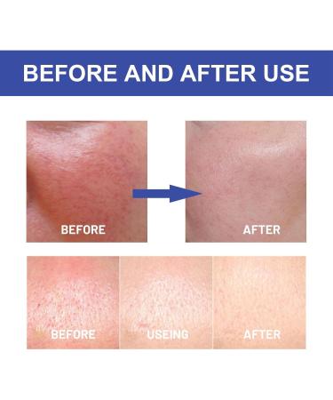 Face Sunscreen SPF 50 Cream (50ml) Hyaluronic Acid Watery Sun Gel - Buy Online on GoSupps.com
