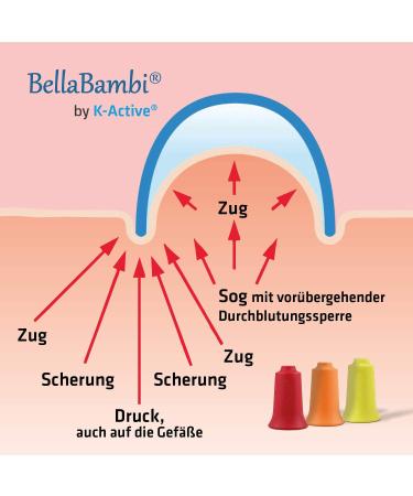 BellaBambi Cupping Cup by K-Active SENSITIVE | Negative Pressure Massage | Yellow | 3.5 cm | International Shipping Available - Buy Online on GoSupps.com