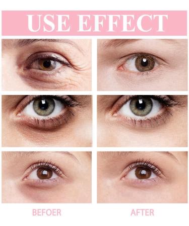 Retinol Eye Stick Retinol Eye Cream for Dark Circles and Puffy Eyes Eye Cream for Wrinkles Under Eye Cream Anti Aging Eye Bags Remover Eye Care Products Instant Wrinkle Remover Firming Eye Cream - Buy Online on GoSupps.com